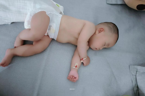 莒县宝宝上火有眼屎